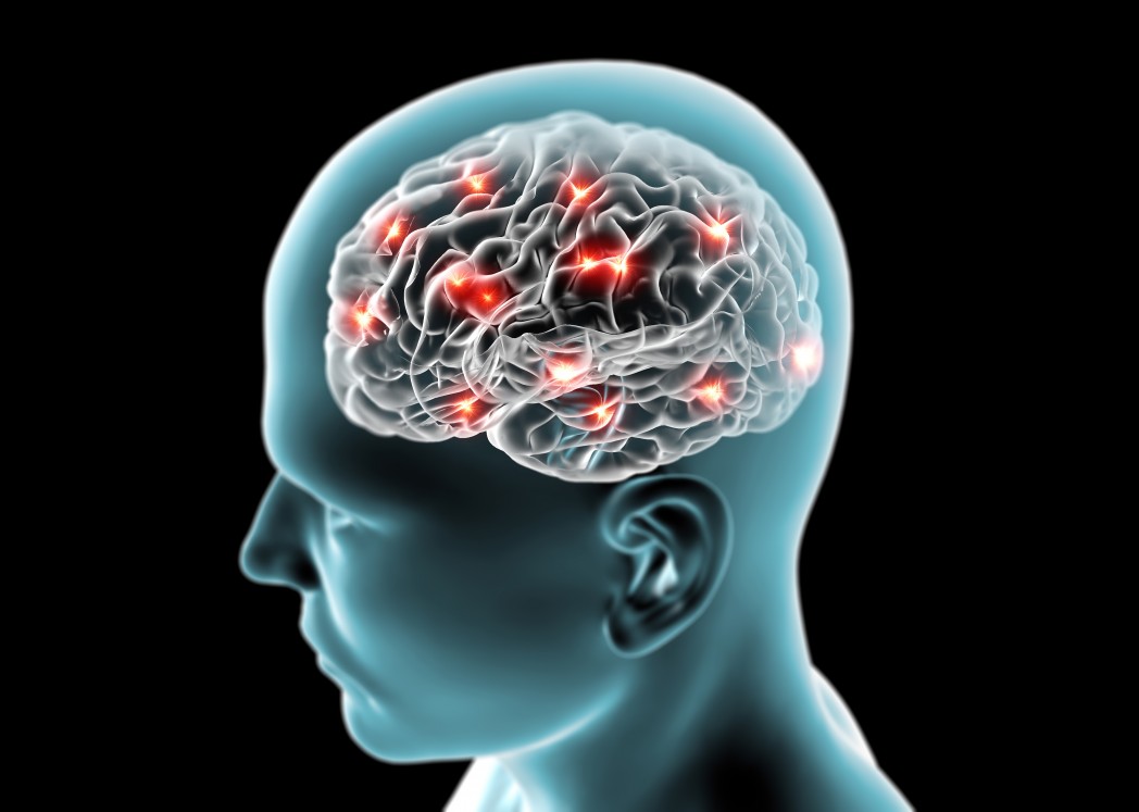 amyotrophic lateral sclerosis