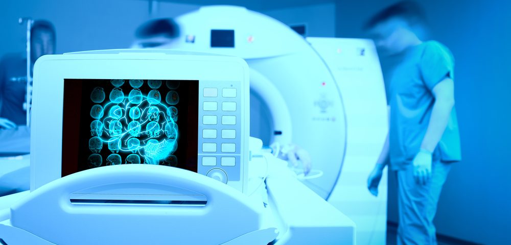 Brain Imaging Studies Seek Signs Of >> Study Brain Imaging May Detect Early Biomarkers In Als Disease Brain Imaging Studies Seek Signs Of >> Study Brain Imaging May Detect Early Biomarkers In Als Disease