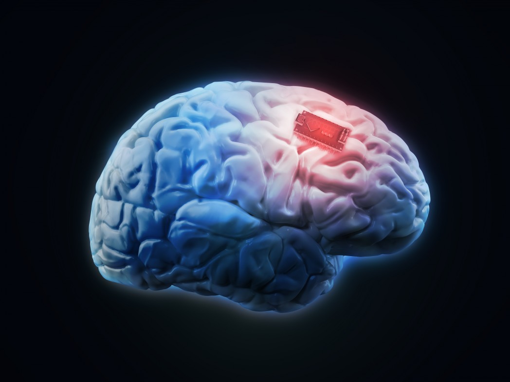 brain implant and ALS