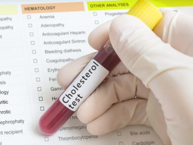 Amyotrophic lateral sclerosis development
