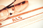 ALS, physician's help to die
