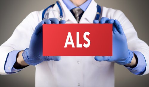 Prognosis of ALS