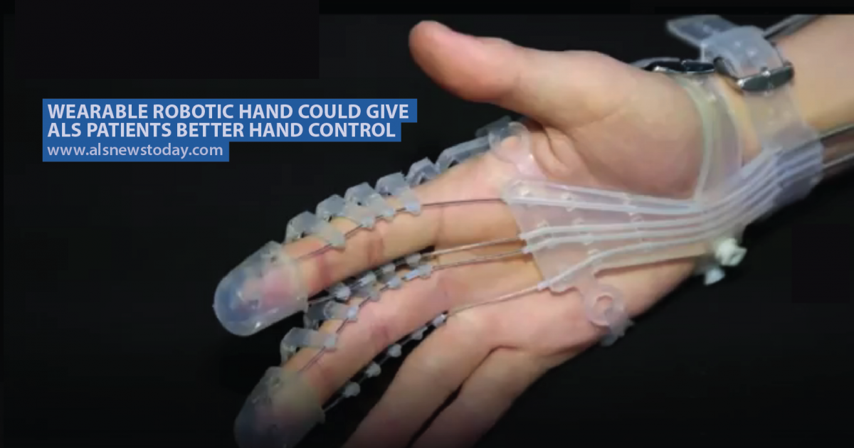 Wearable Robotic Hand Could Give Als Patients Better Hand Control Als