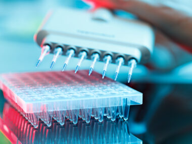 neurofilament light blood levels