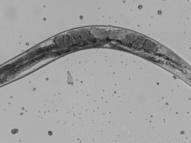 SOD1 protein studied