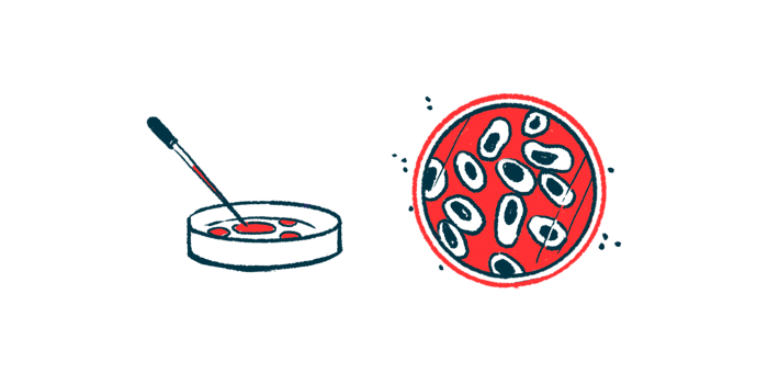 ALS brain inflammation | ALS News Today | cells in petri dish illustration