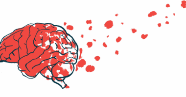 TDP-43 protein | ALS News Today | illustration of brain with disease