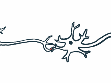 A close-up view of nerve cells show the axons connecting them.