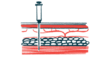 Engensis | ALS News Today | illustration of intramuscular needle injection