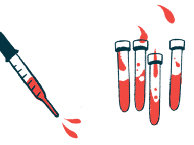 A dropper squirting blood is shown next to four half-filled vials.