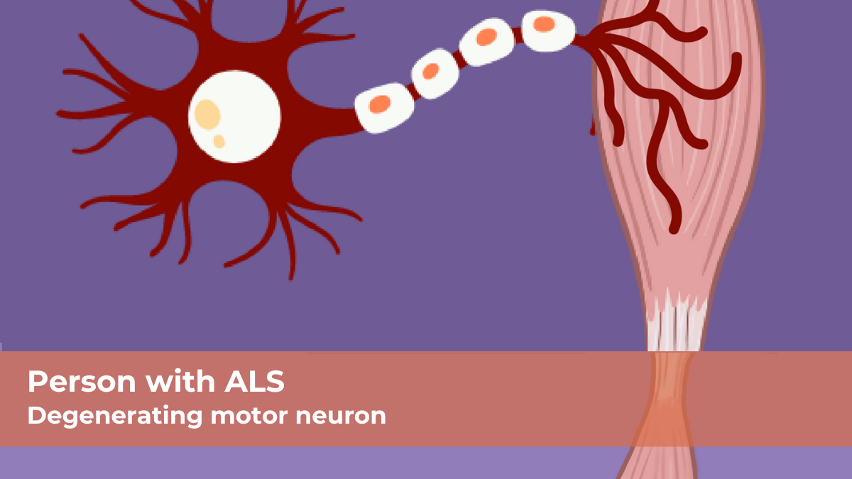 The Mobility issues associated with Amyotrophic Lateral Sclerosis