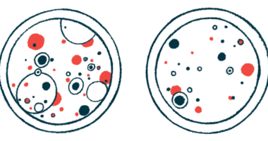 Two petri dishes.