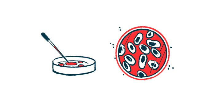 A dropper is seen poised above a petri dish alongside an aerial image of cells in another lab dish.