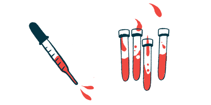 A dropper is shown next to vials containing blood.