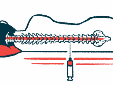 A person lies on his side as medicine is injected directly into the spinal canal, an intrathecal delivery.
