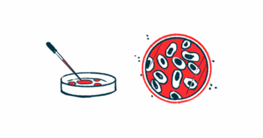 A dropper is seen poised above a petri dish alongside an aerial image of cells in another lab dish.