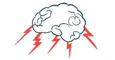 Lightning bolts are seen shooting from the human brain.