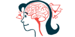 A person's brain is seen in profile.