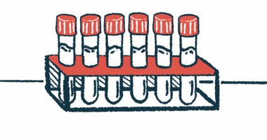 A row of vials sit in a rack.