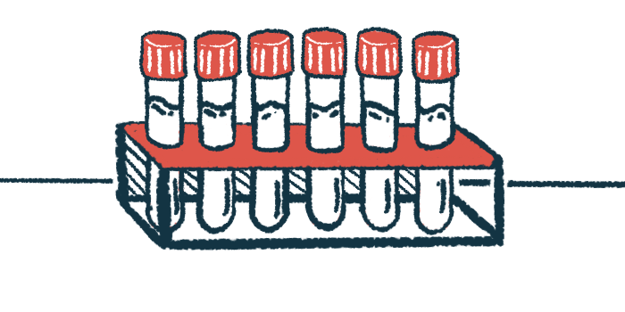 A row of vials sit in a rack.