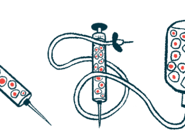 Two syringes and an intravenous medication bag, all for use in delivering a stem cell therapy to a patient, are pictured.